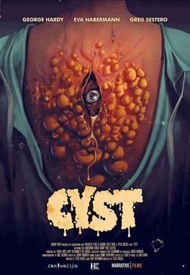 Киста / Cyst (2020) смотреть онлайн бесплатно в отличном качестве